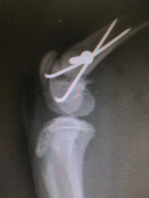 intervencion fractura distal femur gato
