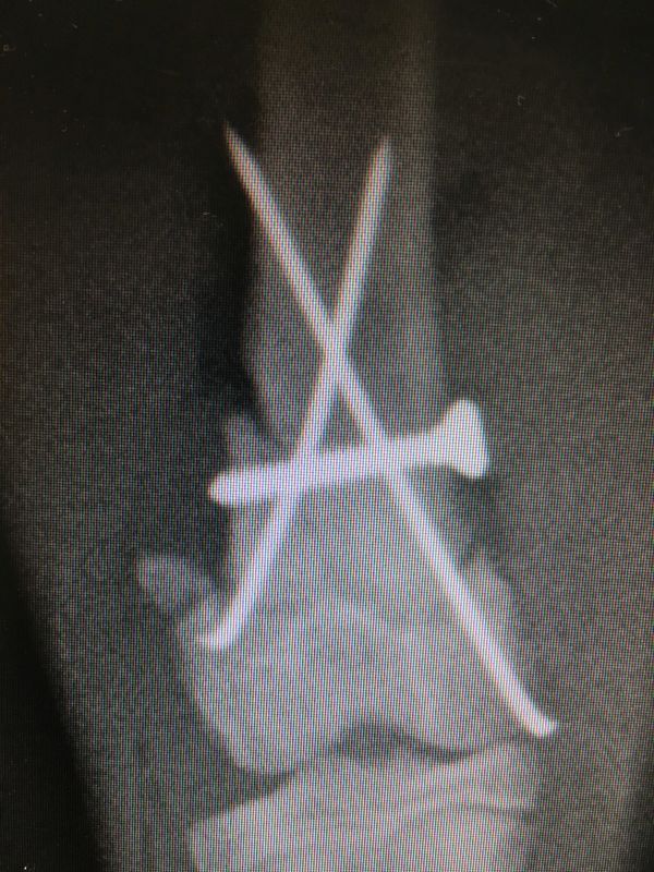 intervencion fractura distal femur gato