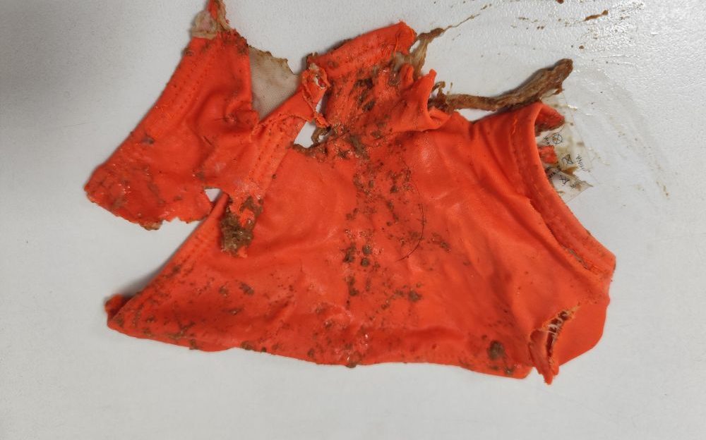 ingestion de bikini