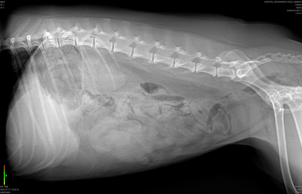 radiografia esplenectomia