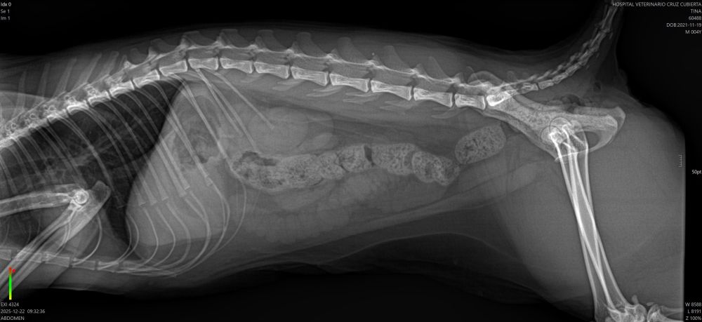 enterotomía para extracción cuerpo extraño lazo navideño