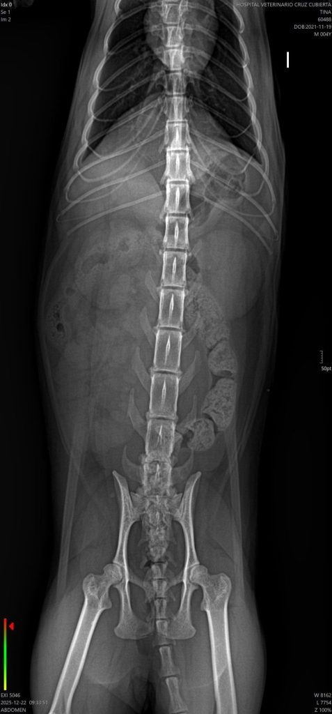 Enterotomía para extracción cuerpo extraño lazo navideño